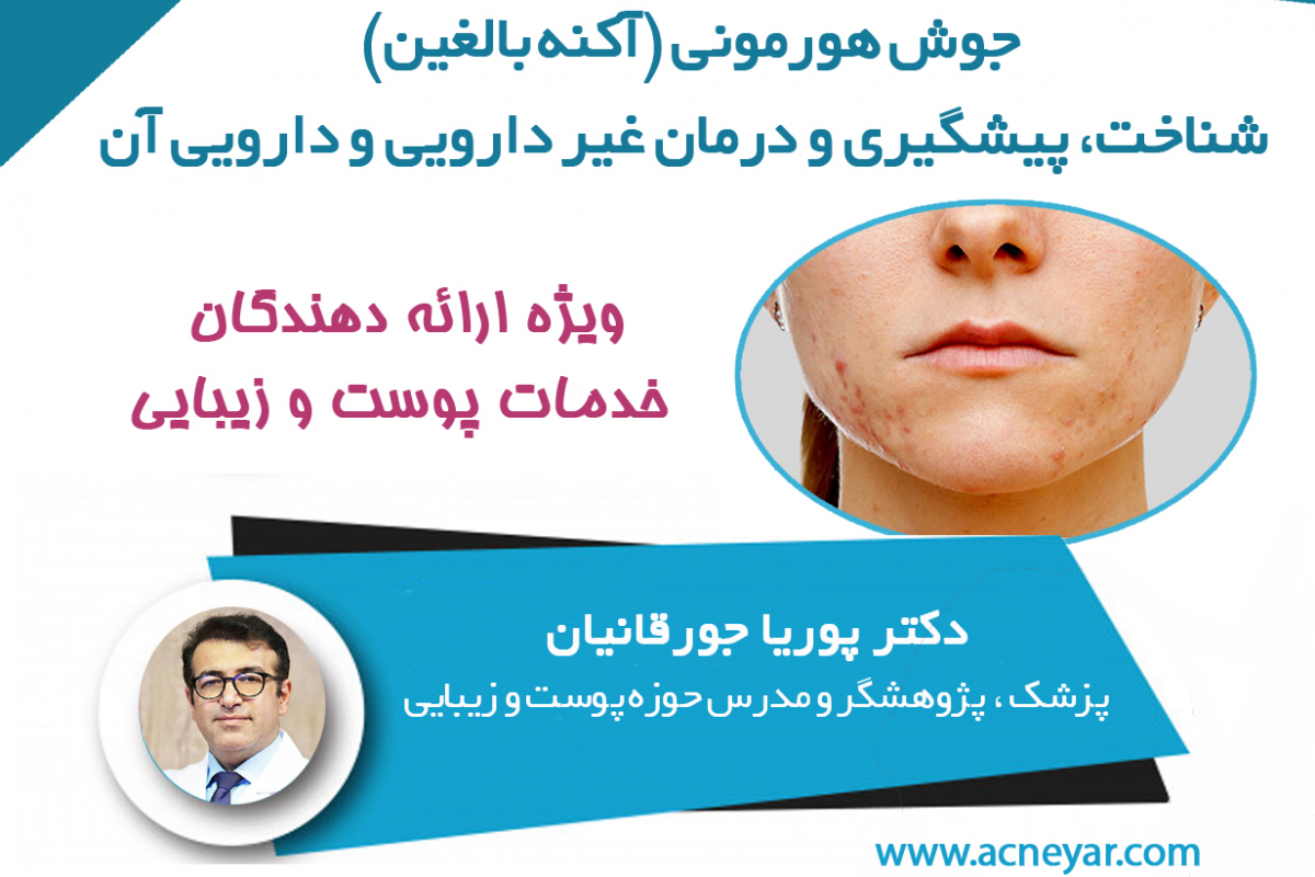 وبینار جوش هورمونی:تشخیص,پیشگیری و درمان آن