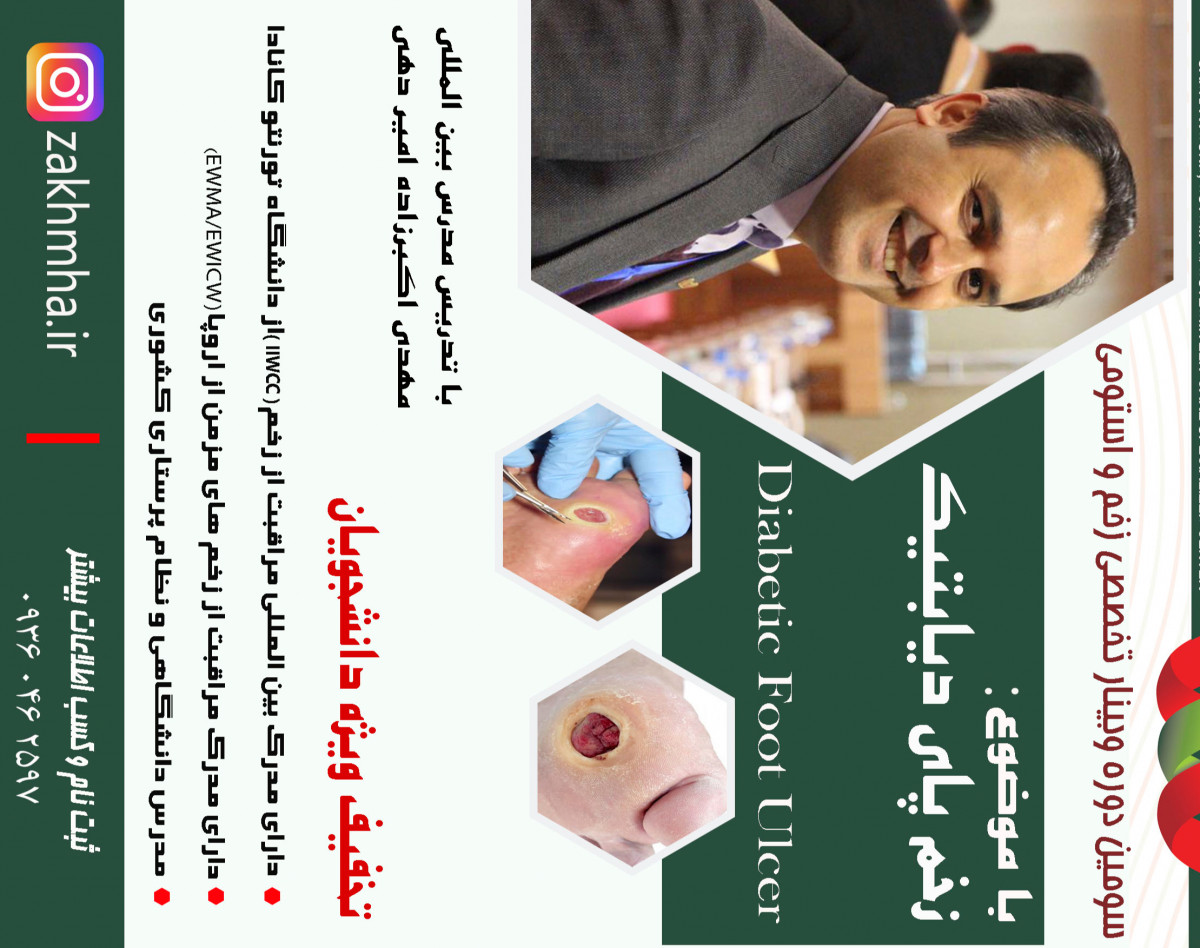 وبینار زخم پای دیابتیک (Diabetic Foot Ulcer)