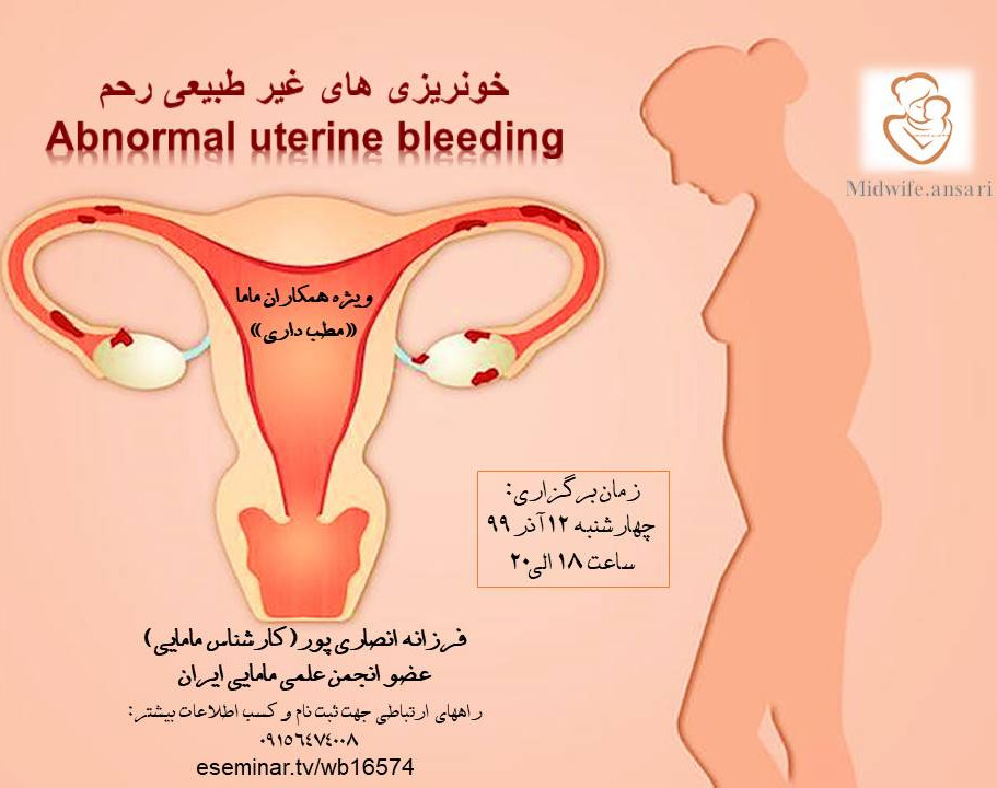 وبینار خونریزی های غیرطبیعی رحم