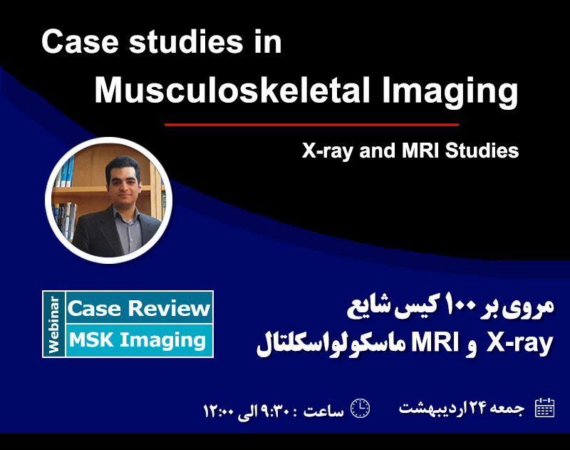 وبینار مروری بر 100 کیس شایع X-ray و MRI ماسکولواسکلتال