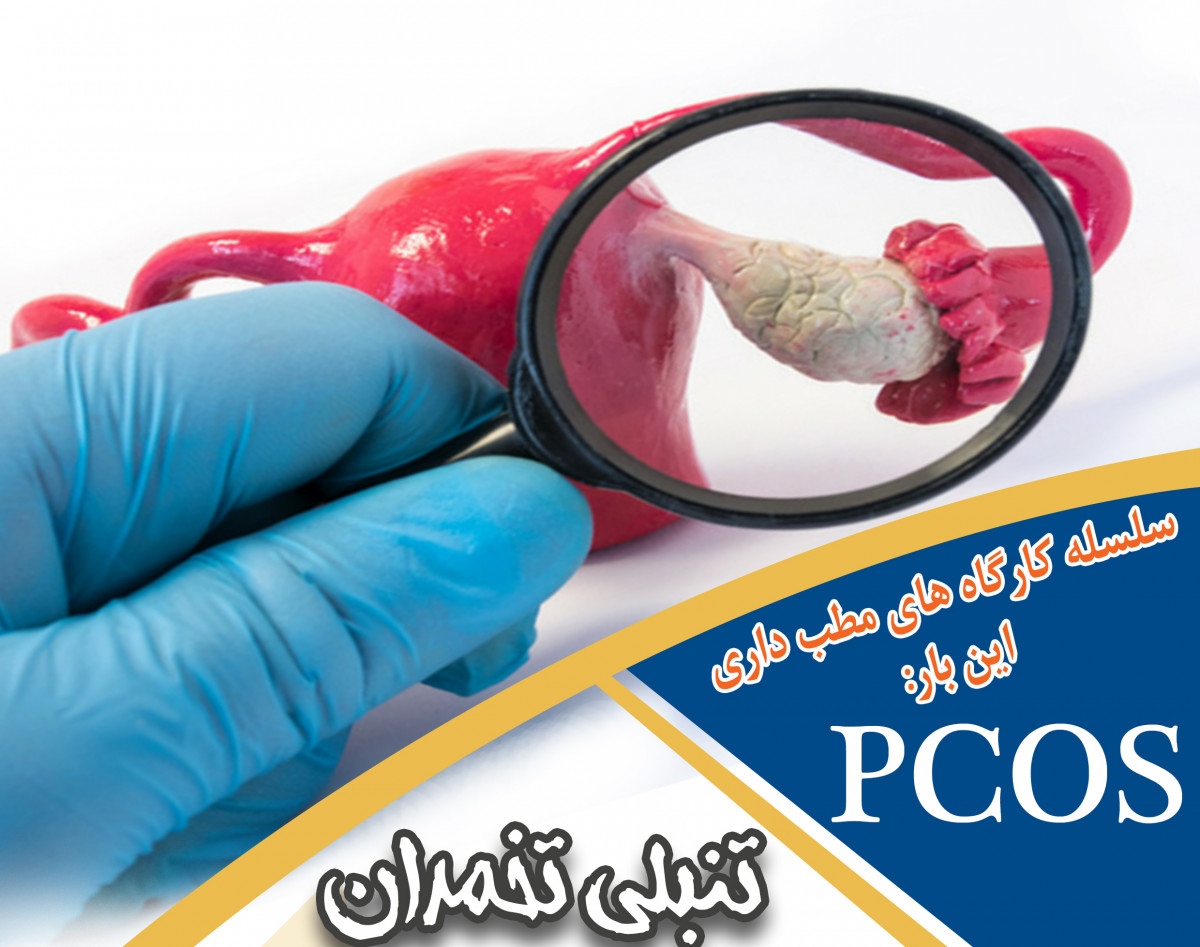 وبینار تنبلی تخمدان دوره 18 مرداد