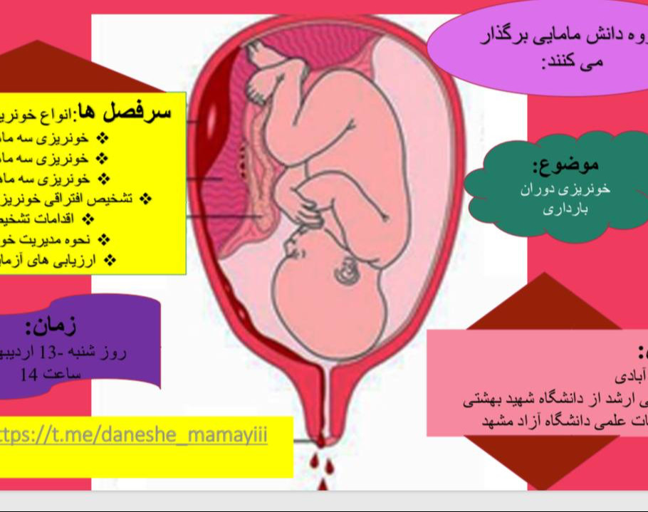 وبینار خونریزی در بارداری