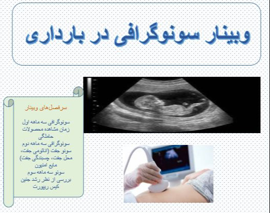 وبینار سونوگرافی در بارداری