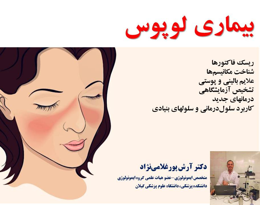 وبینار بیماری لوپوس (مکانیسم، علایم و درمانهای جدید)