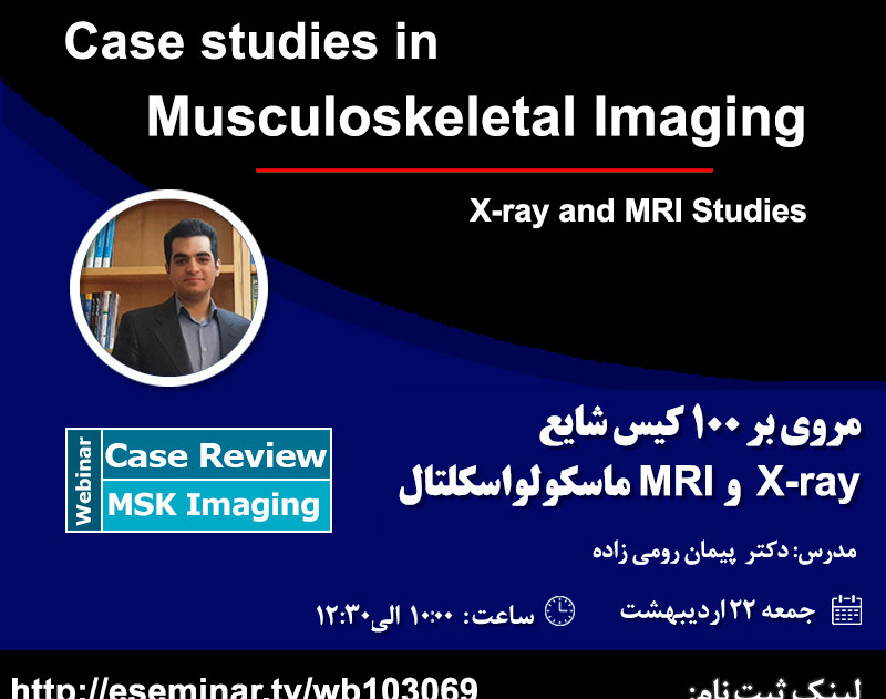 وبینار مروری بر 100 کیس شایع X-ray و MRI ماسکولواسکلتال