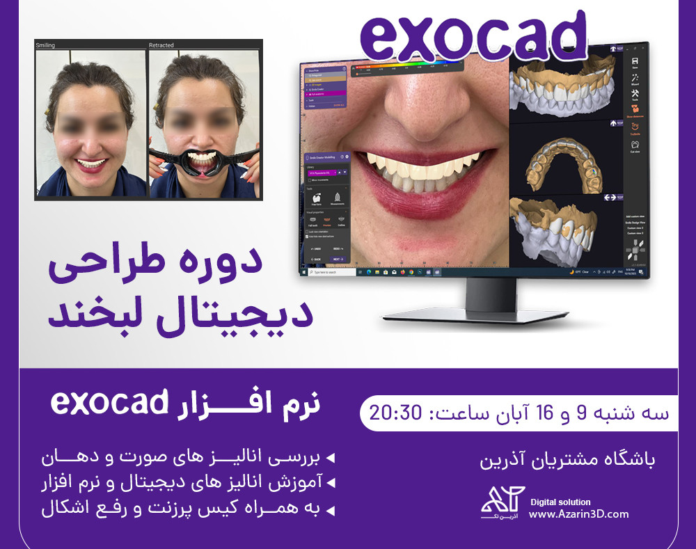وبینار آموزش طراحی لبخند و ساخت لمینت با نرم افزار Exocad