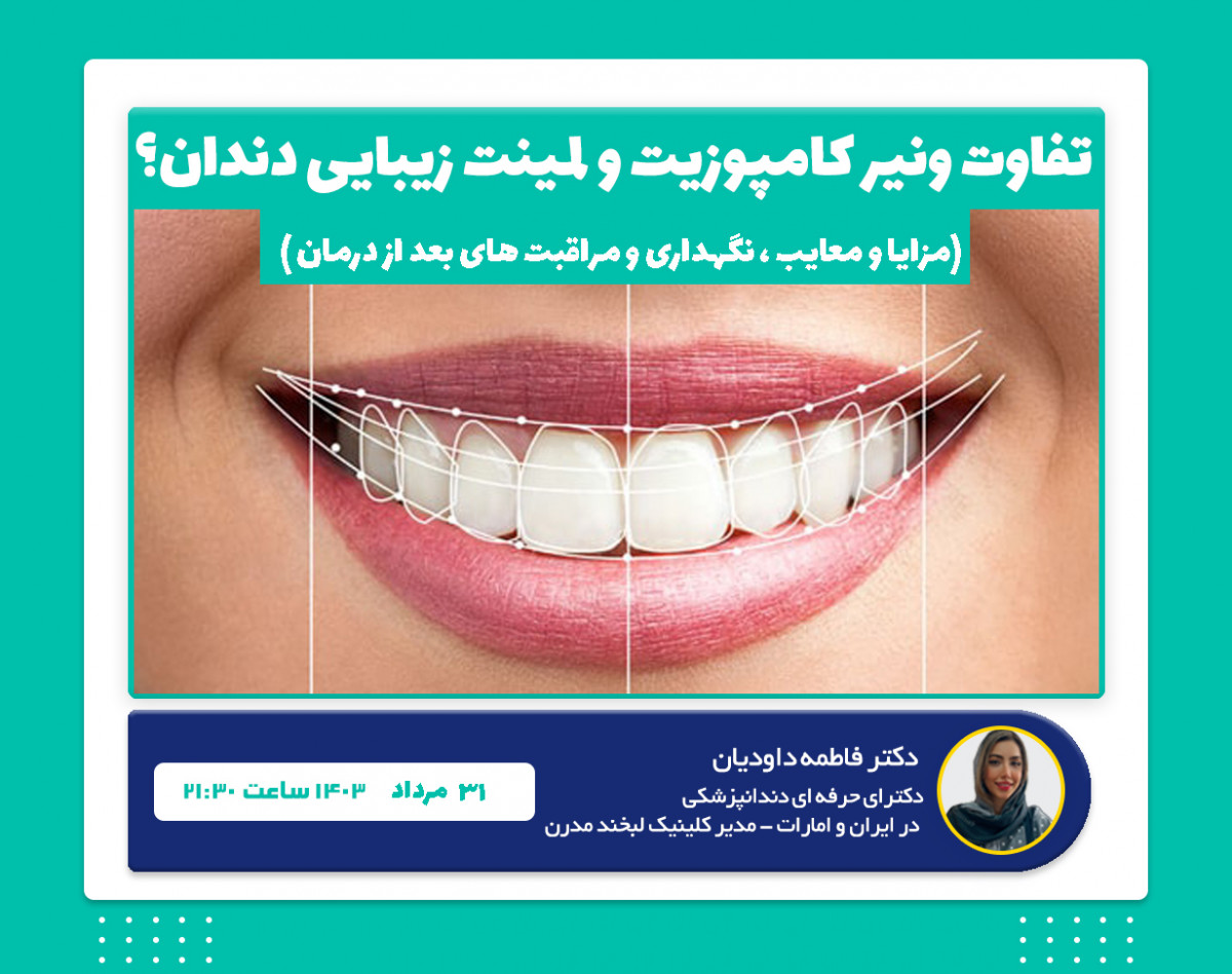 وبینار تفاوت ونیر کامپوزیت و لمینت زیبایی دندان؟ و راه های مراقبت از آن