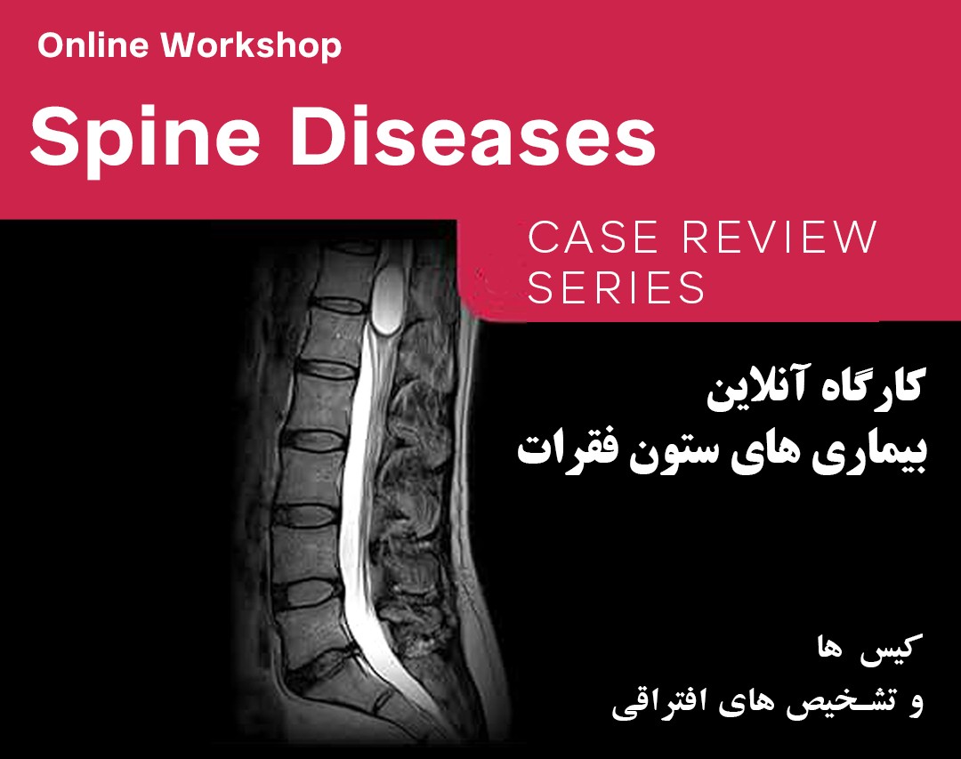 وبینار بیماری های ستون فقرات: کیس ها و تشخیص های افتراقی