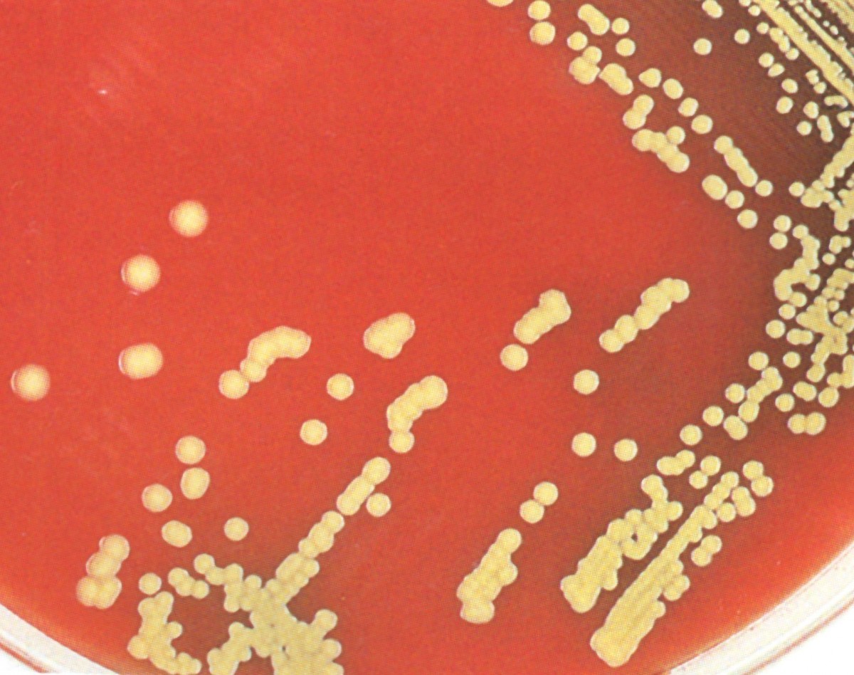 وبینار ارتباط بین تغذیه ومیکروبیوم درایام عیدنوروز