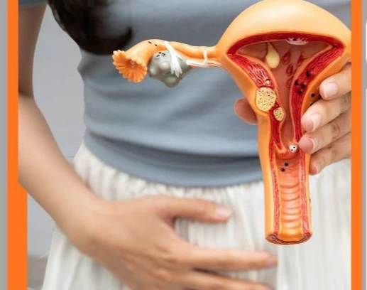 وبینار خونریزی های غیر طبیعی زنان (AUB/DUB)